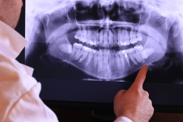 Best Emergency Treatment for Dental Infections or Abscesses in Danville, AR