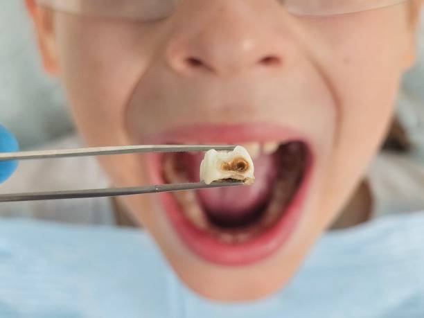 Best Urgent Care for Lost Fillings or Crowns in Danville, AR