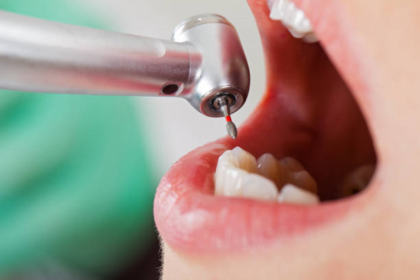 Best Emergency Gum Treatment in Danville, AR